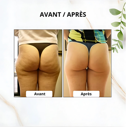 Masseur Gua Sha anti-cellulite