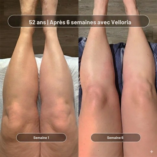 Huile de massage anti-cellulite