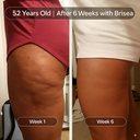 Huile de massage anti-cellulite
