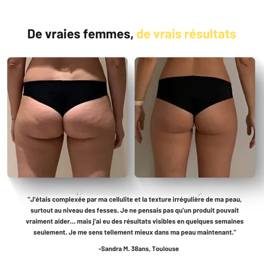 Huile de massage anti-cellulite