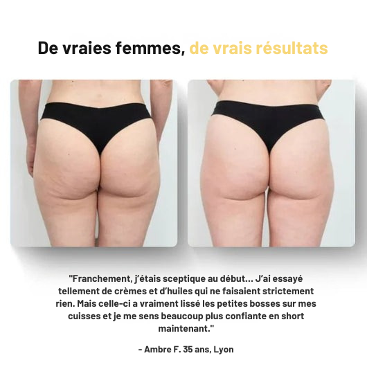 Huile de massage anti-cellulite