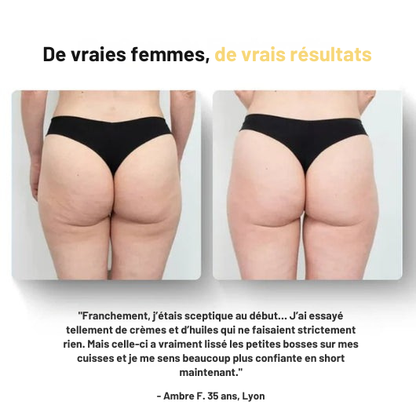 Huile de massage anti-cellulite