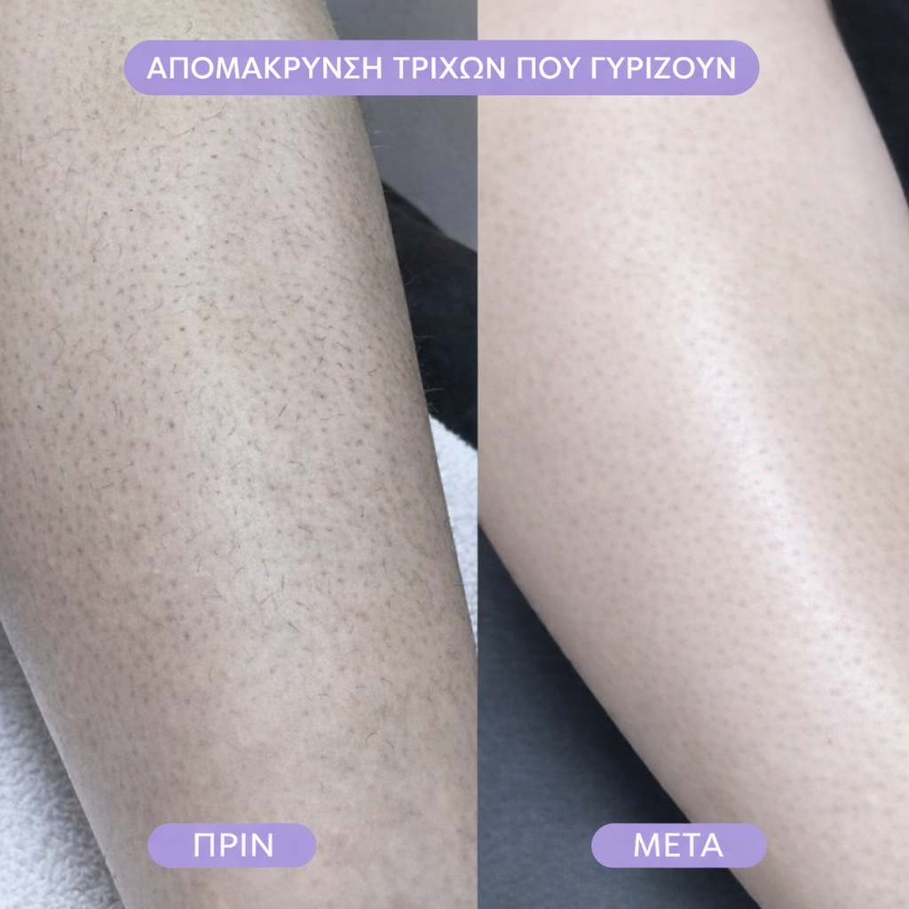 Γόμα μαλλιών Bleame Crystal