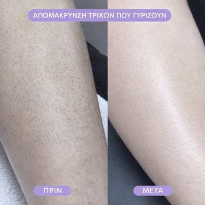 Γόμα μαλλιών Bleame Crystal