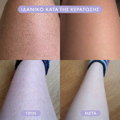 Γόμα μαλλιών Bleame Crystal